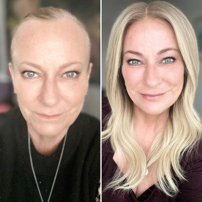 Innerbloom Minoxidil Drops