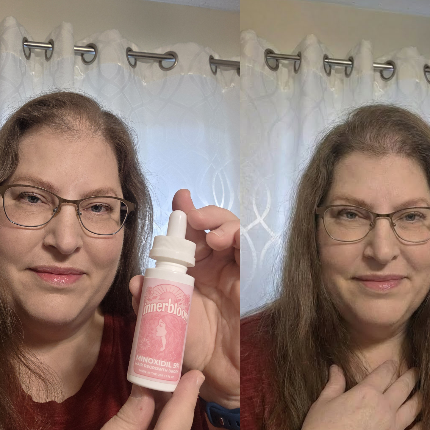 Minoxidil 5% Hair Growth Drops for Women (Made in USA) 2 Pack