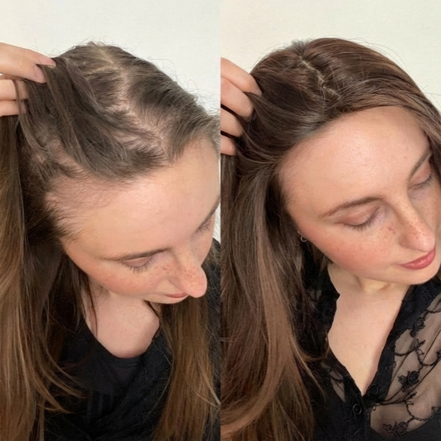 Innerbloom Minoxidil Drops