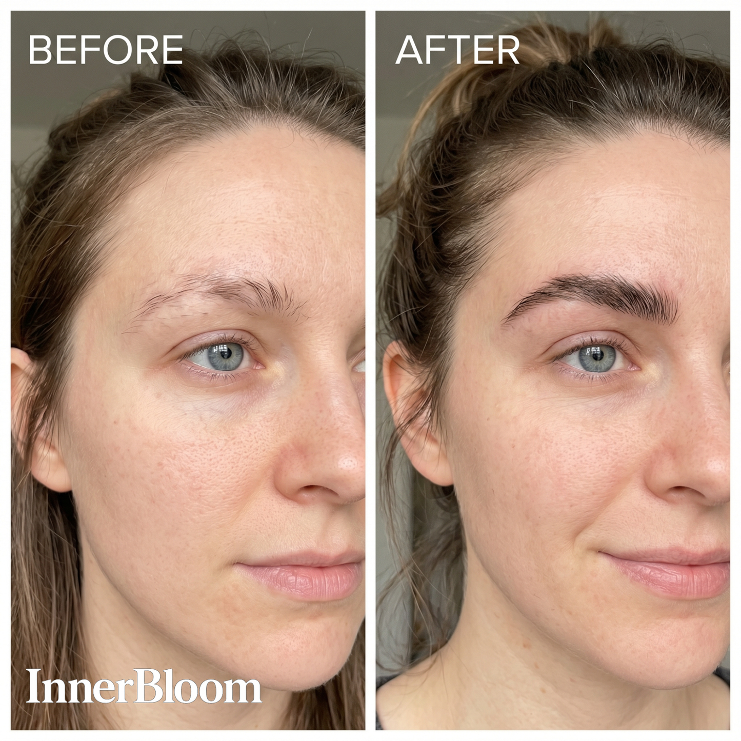 Innerbloom Minoxidil Eyebrow Boosting Serum